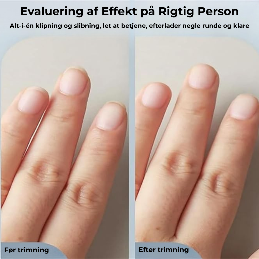 Smart NegleTrimmer | Bærbar elektrisk negleklipper