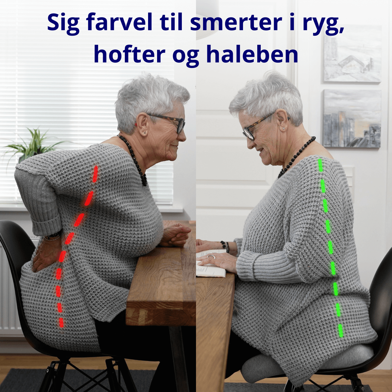 SiddeForm™ Siddepude