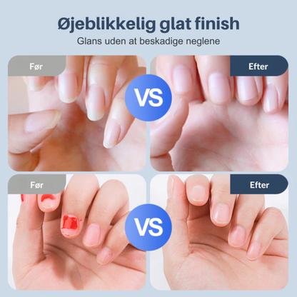 EasyClip™ Elektrisk Negleklipper