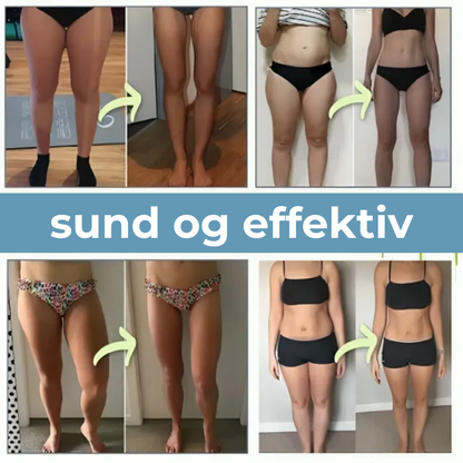 VitalBen™ | Innovativ NMES fodmassage til blodcirkulation og væskestrøm