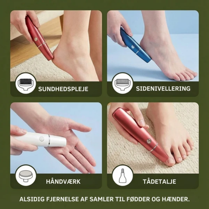 BlødeHæle™ - Silkebløde fødder på kun 5 minutter