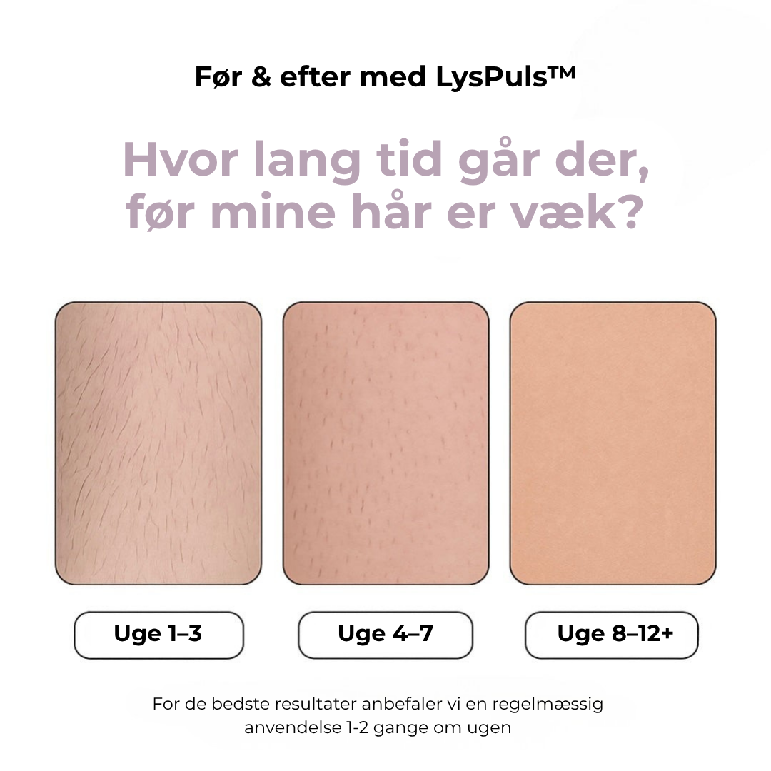 LysPuls™ IPL hårfjerner til hjemmebrug – salonresultat uden salonpris