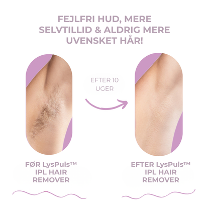 LysPuls™ IPL hårfjerner til hjemmebrug – salonresultat uden salonpris